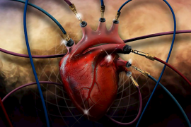 “世界最小人工心脏”！美国一款心脏泵已致49人死亡：最高级别召回警报