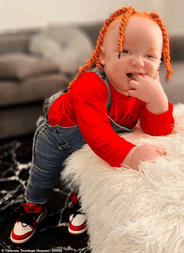 黑人父母生下奇怪的白宝宝：白色皮肤 姜黄色头发-图4