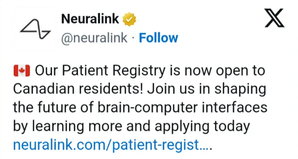 不局限于美国人！Neuralink患者登记向加拿大居民开放